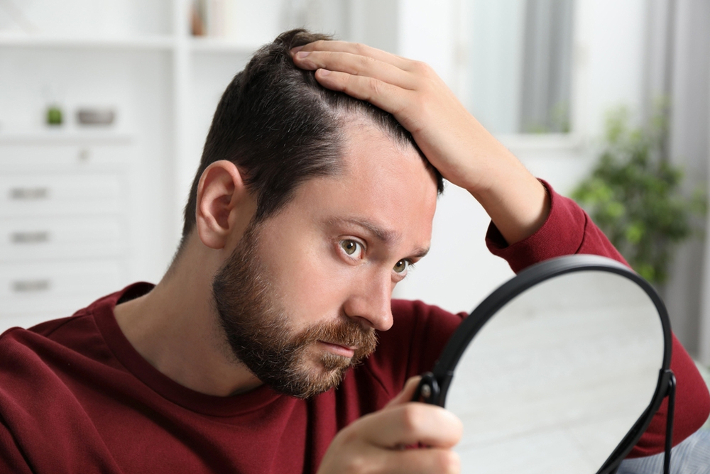 hair fall men