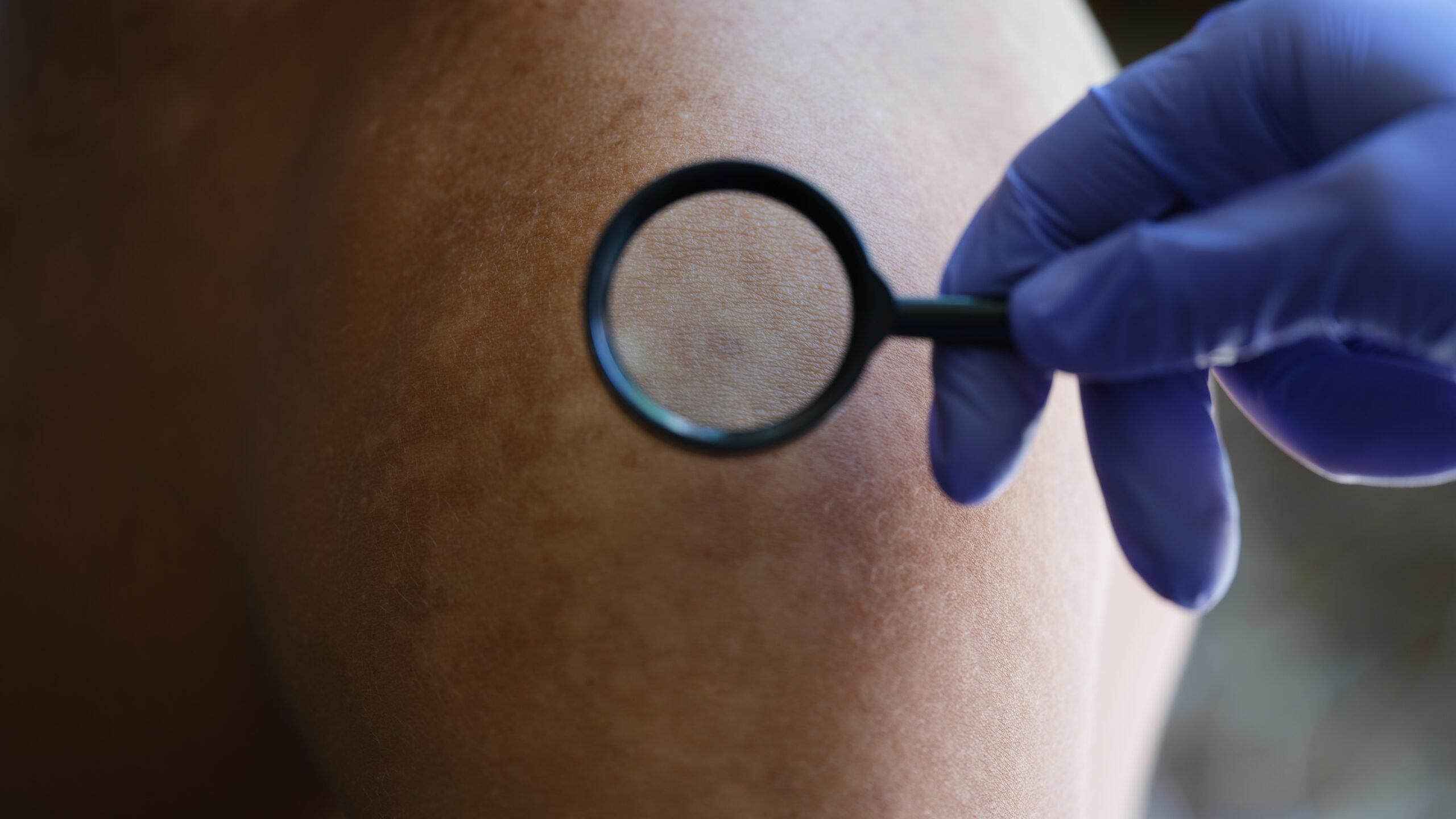 best skin specialist in Jayanagar