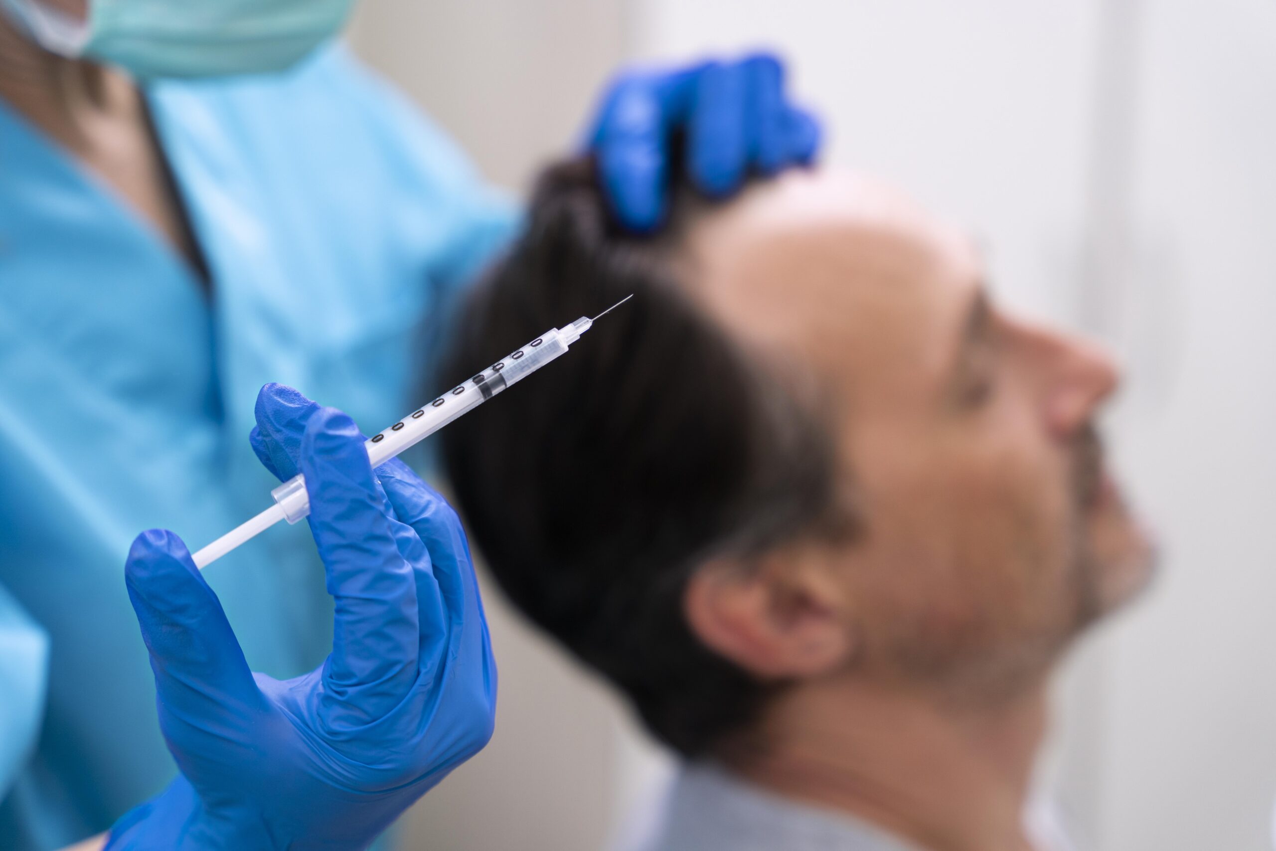 PRP Hair Treatment in Jayanagar, Bangalore