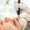 Closeup,Shot,Of,Young,Woman,Receiving,Microdermabrasion,Therapy,On,Forehead